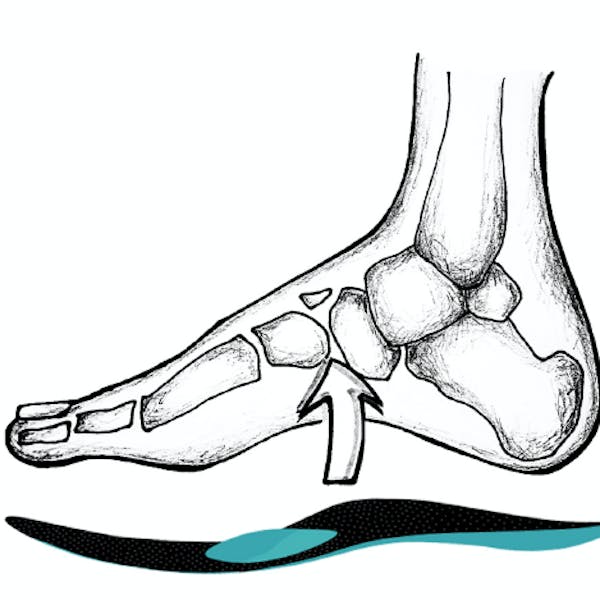 craftsoles Einlagen Fußfehlstellung